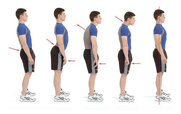 Prevención da osteocondrose
