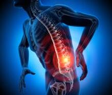 varias causas de dores nas costas