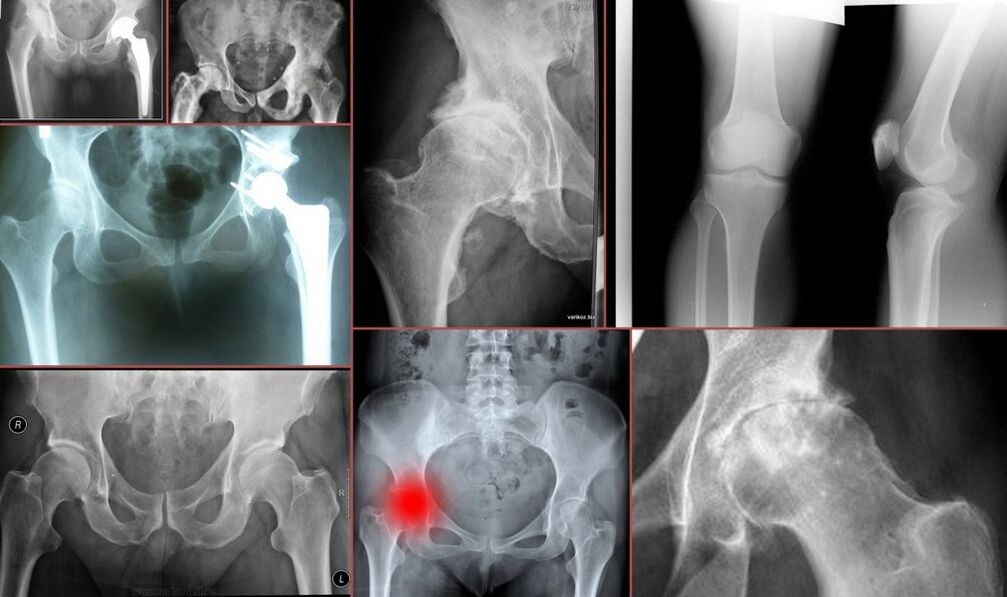 Radiografía para a dor de cadeira