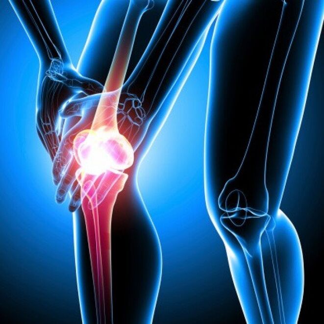 A artrite reumatoide en fase avanzada pode causar dor de cadeira
