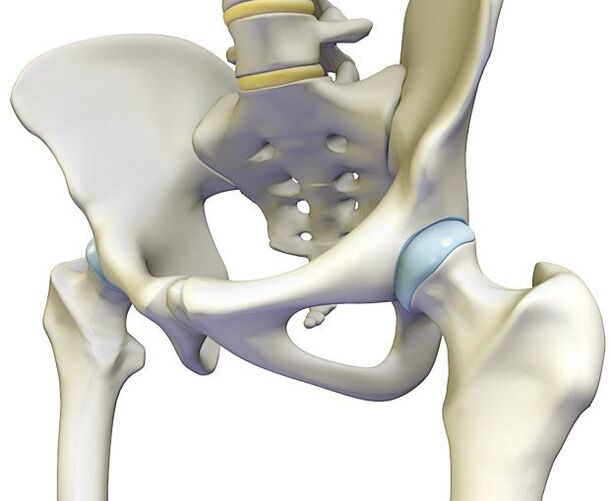 A osteocondrose provoca unha dor aguda na articulación da cadeira
